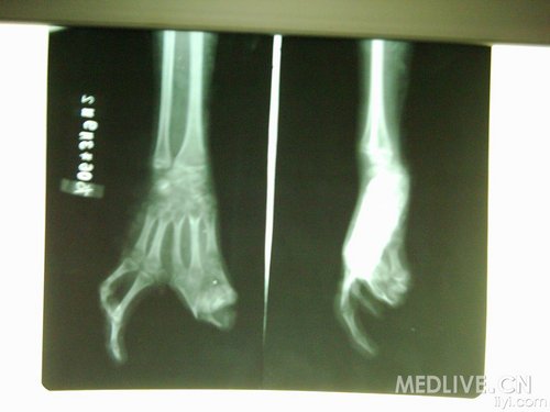 http://group.medlive.cn/webres/upload/000/008/257
