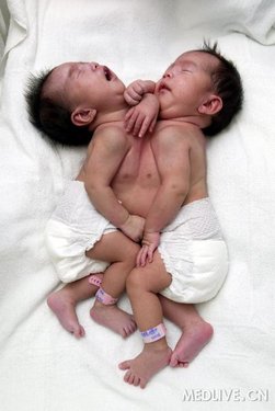 http://group.medlive.cn/webres/upload/000/009/392