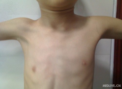 http://group.medlive.cn/webres/upload/000/010/944