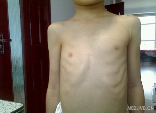 http://group.medlive.cn/webres/upload/000/010/945
