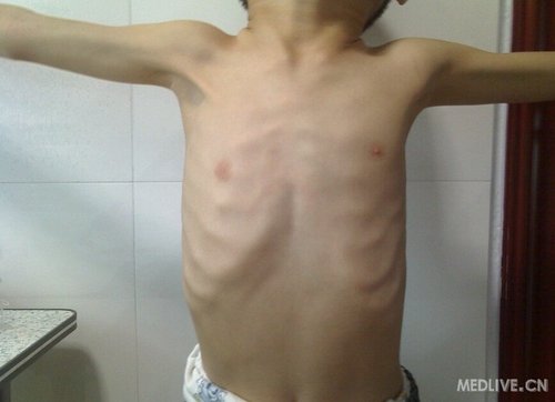 http://group.medlive.cn/webres/upload/000/010/946