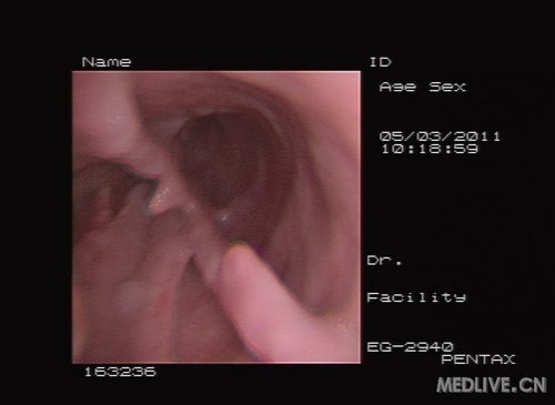 http://group.medlive.cn/webres/upload/000/019/823