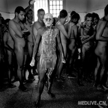 http://group.medlive.cn/webres/upload/000/055/370