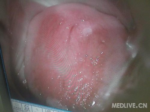 http://group.medlive.cn/webres/upload/000/068/844