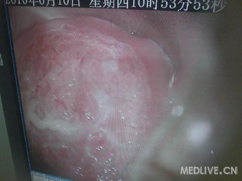 http://group.medlive.cn/webres/upload/000/068/845