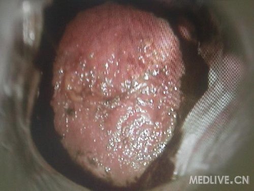 http://group.medlive.cn/webres/upload/000/068/846