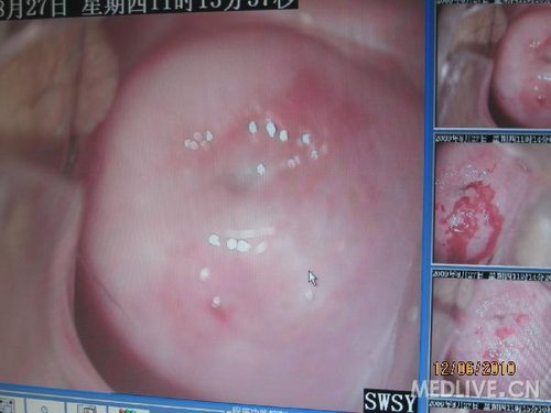 http://group.medlive.cn/webres/upload/000/068/847