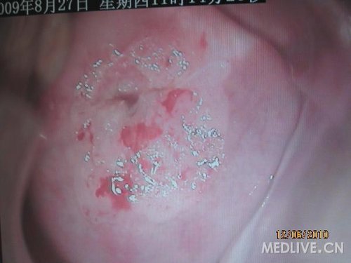 http://group.medlive.cn/webres/upload/000/068/848