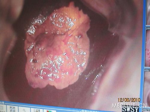 http://group.medlive.cn/webres/upload/000/068/849