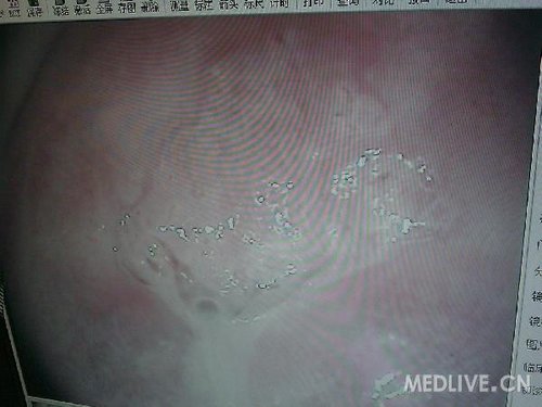 http://group.medlive.cn/webres/upload/000/068/850