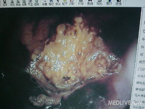 http://group.medlive.cn/webres/upload/000/068/851
