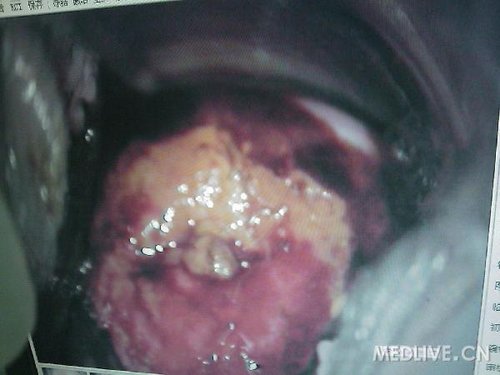 http://group.medlive.cn/webres/upload/000/068/852