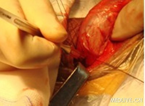 http://group.medlive.cn/webres/upload/000/084/364