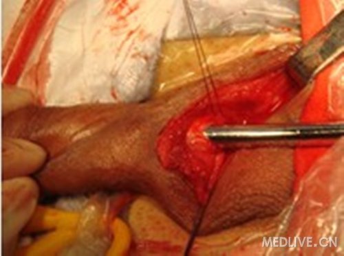 http://group.medlive.cn/webres/upload/000/084/365