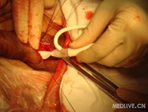 http://group.medlive.cn/webres/upload/000/084/367