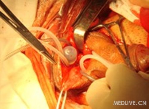 http://group.medlive.cn/webres/upload/000/084/368
