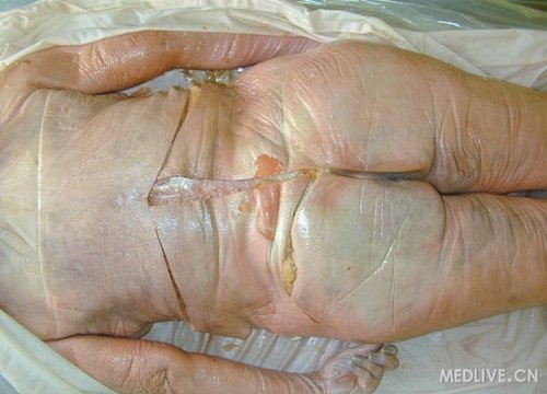 真实解剖图饭后别近来