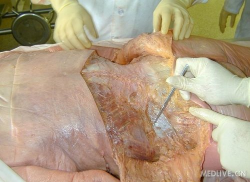 真实解剖图饭后别近来