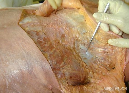 真实解剖图饭后别近来