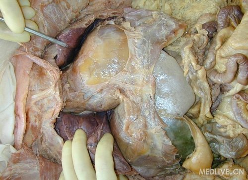 真实解剖图饭后别近来