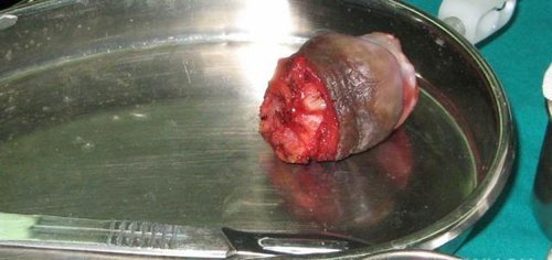 medlive.cn/webres/upload/000/042/671