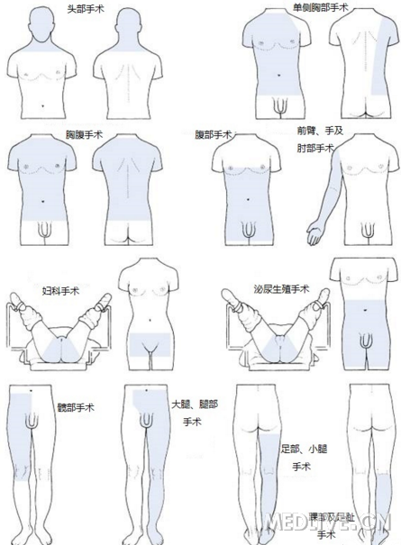 下肢手术消毒范围图解图片